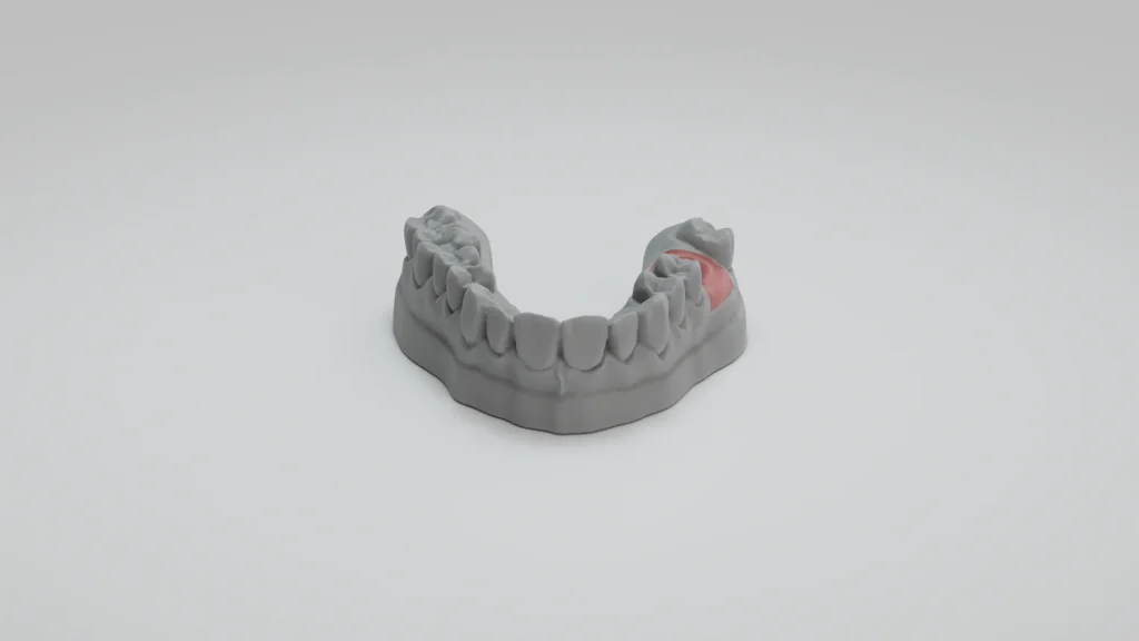 Model zubního oblouku s gingivální maskou z materiálu Model GP